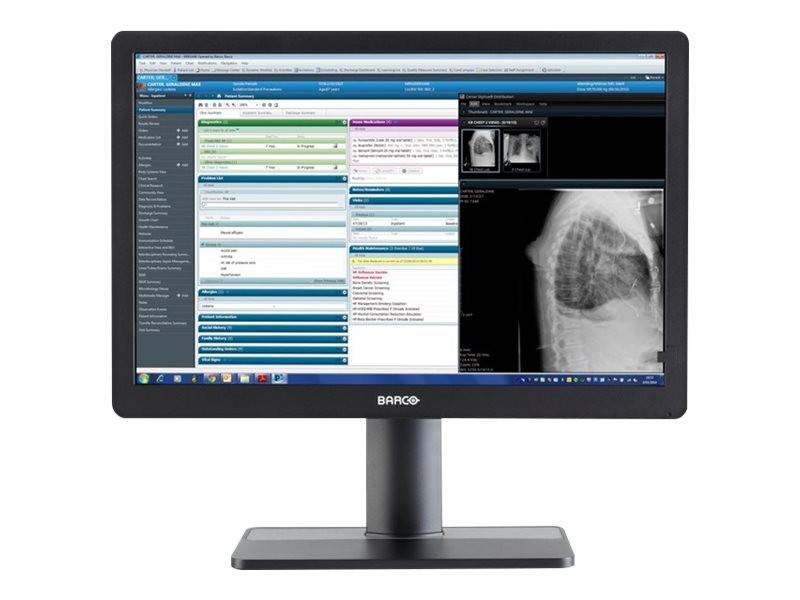 NEW SEALED Barco Eonis MDRC-2324 SNIB 2MP 24" Clinical Review Monitor - K9350055