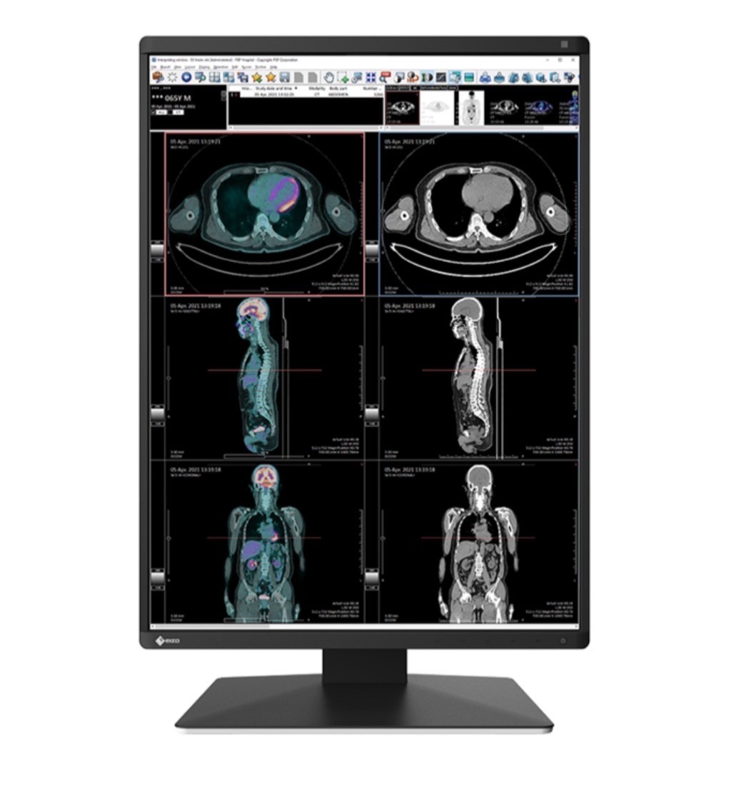 EIZO RadiForce RX370 Medical Imaging Monitor Low Hours
