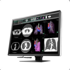 EIZO RadiForce RX1270 12MP 30.9