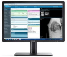 Barco® Eonis MDRC-2222 BL 22